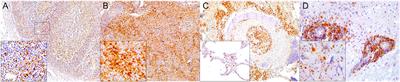 Comparative Immunopathology of Cetacean morbillivirus Infection in Free-Ranging Dolphins From Western Mediterranean, Northeast-Central, and Southwestern Atlantic